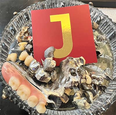 Silberfarbenes Dentalgold und Zahngold zur Prüfung