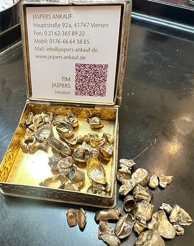 Gelbes Zahngold und Dentallegierungen bei JASPERS-Ankauf